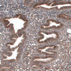 Anti-RBCK1 Antibody