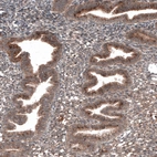 Immunohistochemical staining of human endometrium shows cytoplasmic positivity in glandular cells.