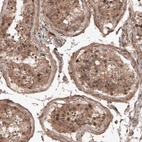 Immunohistochemical staining of human testis shows cytoplasmic positivity in seminiferous tubules.