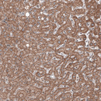 Immunohistochemical staining of human liver shows cytoplasmic immunoreactivity in hepatocytes.