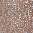 Anti-RBCK1 Antibody