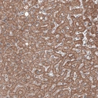 Immunohistochemical staining of human liver shows cytoplasmic immunoreactivity in hepatocytes.