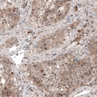 Anti-USP30 Antibody
