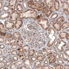 Immunohistochemical staining of human kidney shows moderate cytoplasmic positivity in cells in tubules.