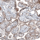 Immunohistochemical staining of human placenta shows moderate cytoplasmic positivity in trophoblastic cells.