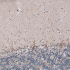 Immunohistochemical staining of human cerebellum shows moderate cytoplasmic positivity in Purkinje cells.