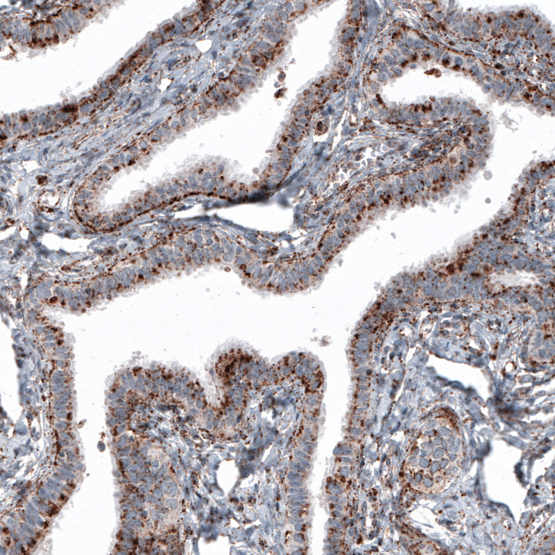 Anti-LAMP1 Antibody