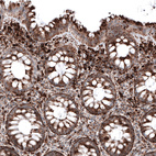 Immunohistochemical staining of human rectum shows strong granular cytoplasmic positivity in glandular and connective tissue cells.