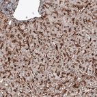 Immunohistochemical staining of human liver shows granular cytoplasmic immunoreactivity in hepatocytes.