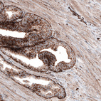 Immunohistochemical staining of human prostate shows strong granular cytoplasmic positivity in glandular cells and weaker staining in smooth muscle.