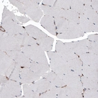 Immunohistochemical staining of human skeletal muscle shows only weak cytoplasmic positivity in muscle fibers.