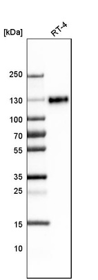 Western blot analysis in human cell line RT-4.
