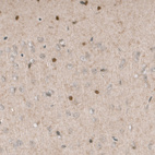 Immunohistochemical staining of mouse cerebral cortex shows nuclear positivity in a subset of cells.