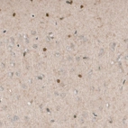 Immunohistochemical staining of mouse cerebral cortex shows nuclear positivity in a subset of cells.