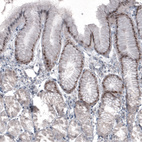 Anti-SOX21 Antibody