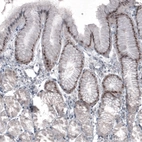 Immunohistochemical staining of human stomach shows moderate nuclear immunoreactivity in a subset of glandular cells.