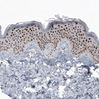 Anti-SOX21 Antibody