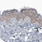 Immunohistochemical staining of human skin shows nuclear immunoreactivity in squamous epithelium cells.