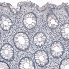 Immunohistochemical staining of human rectum shows no positivity as expected (negative control).