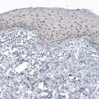 Immunohistochemical staining of human cervix shows moderate nuclear immunoreactivity in a subset of squamous epithelial cells.