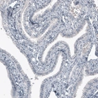 Immunohistochemical staining of human fallopian tube shows no positivity as expected (negative control).