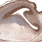 Immunohistochemical staining of mouse embryo E14 shows nuclear immunoreactivity in the developing forebrain.