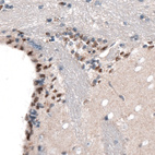 Anti-SOX21 Antibody