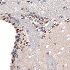 Immunohistochemical staining of mouse forebrain shows nuclear immunoreactivity in a subset of cells in the lateral ventricle wall.