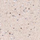 Immunohistochemical staining of mouse cerebral cortex shows nuclear positivity in a subset of cells.