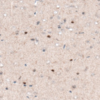 Anti-SOX21 Antibody