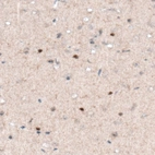 Immunohistochemical staining of mouse cerebral cortex shows nuclear positivity in a subset of cells.