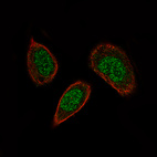 Immunofluorescence staining of PC-3 cells using the Anti-SOX21 monoclonal antibody, showing specific staining in the nucleus in green. Microtubule- and nuclear probes are visualized in red and blue, respectively (where available).