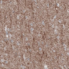 Immunohistochemical staining of human cerebral cortex shows strong positivity in neural fibers.