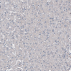 Immunohistochemical staining of human liver shows no positivity as expected (negative control).