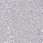 Immunohistochemical staining of human liver shows no positivity as expected (negative control).