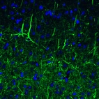 Immunofluorescence staining of mouse cerebral cortex shows strong immunoreactivity in neuronal cell bodies and processes.