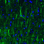 Anti-NEFL Antibody