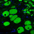 Immunofluorescence staining of rat brainstem shows strong immunoreactivity in neuronal cell bodies.