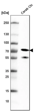 Western blot analysis in human cerebral cortex tissue.