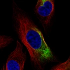 Immunofluorescence staining of PC-3 cells using the Anti-NEFL monoclonal antibody, showing specific staining in intermediate filaments in green. Microtubule- and nuclear probes are visualized in red and blue, respectively (where available).