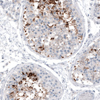 Anti-CT83 Antibody