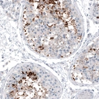 Immunohistochemical staining of human testis shows moderate to strong cytoplasmic positivity in a subset of cells in seminiferous ducts.