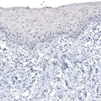 Immunohistochemical staining of human uterine cervix shows no positivity in squamous epithelial cells as expected.