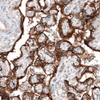 Anti-CLIP1 Antibody