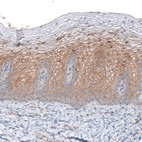 Immunohistochemical staining of human cervix shows moderate cytoplasmic positivity in squamous epithelial cells.