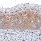 Immunohistochemical staining of human cervix shows moderate cytoplasmic positivity in squamous epithelial cells.