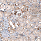 Anti-CLIP1 Antibody