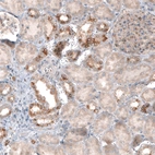 Immunohistochemical staining of human kidney shows moderate cytoplasmic immunoreactivity in a subset of renal tubules.
