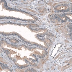 Immunohistochemical staining of human prostate shows weak cytoplasmic positivity in glandular and smooth muscle cells.