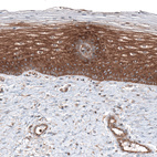 Immunohistochemical staining of human cervix shows strong cytoplasmic positivity in squamous epithelial cells.